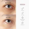 IMG_8228 Contorno De Ojos To Be Youthful Eye Serum de DR. ALTHEA- 25ml