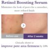 Serum Antiedad Retinol NMN Boosting Serum de MEDICUBE- 30ML